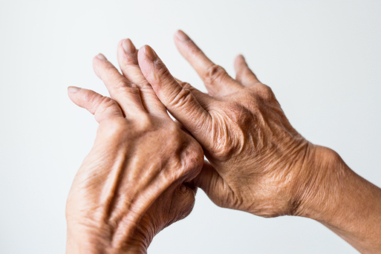 How to Manage Your Lifestyle with Rheumatic Conditions