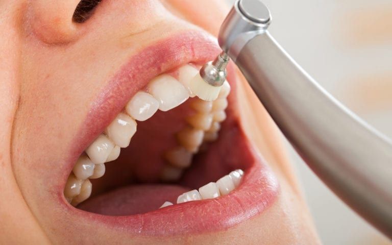 A Complete Guide to Permanent Tooth Restoration Solutions